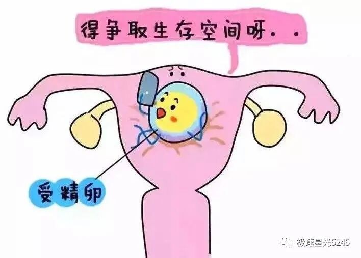 子宫球囊支架怎么取宫腔粘连让你“孕”气不佳，一次性使用三角球囊支架助你心想事成_https://www.jmylbn.com_新闻资讯_第3张