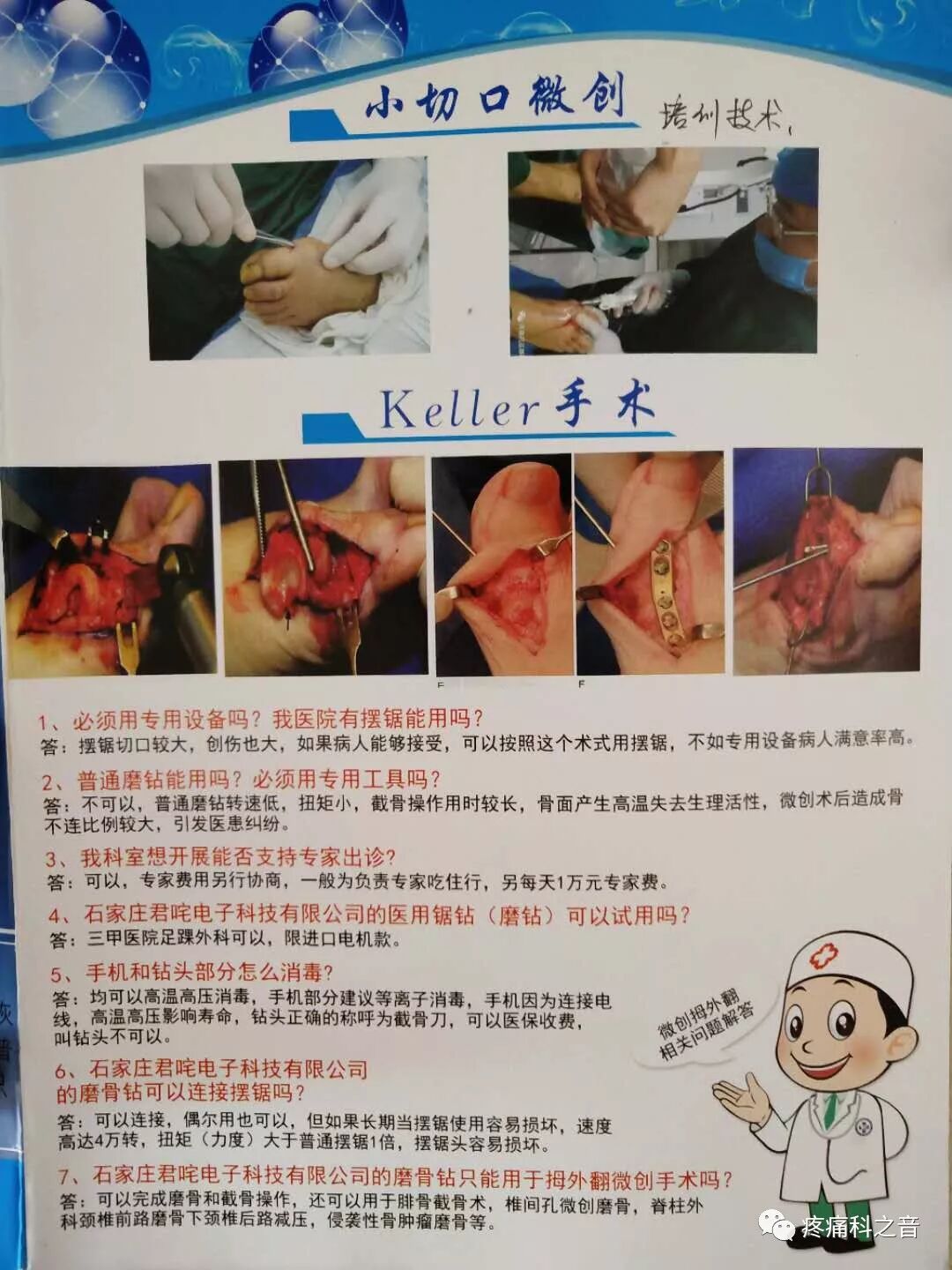 医用磨钻什么牌子好微创拇外翻专用设备-医用电动磨钻_https://www.jmylbn.com_新闻资讯_第28张