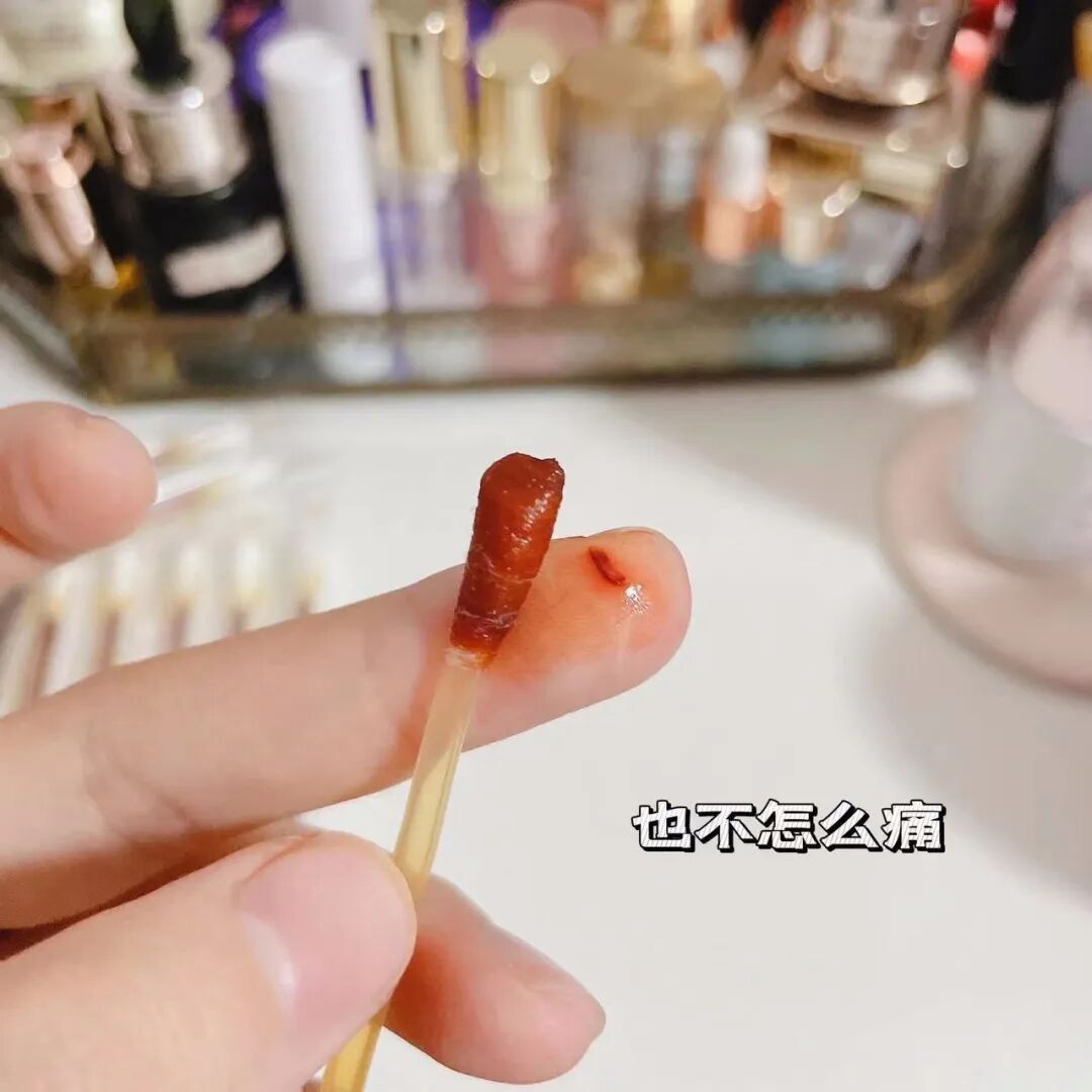 一次性碘伏棉签怎么用②FEROLAN一次性碘伏／酒精棉签(2盒)｜除菌、护理二合一，超省心，家庭药箱必备_https://www.jmylbn.com_新闻资讯_第35张