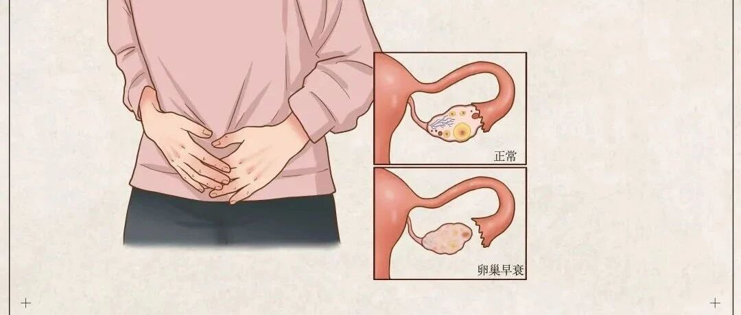 增加早死风险、抑郁、易胖...卵巢早衰危害那么大？