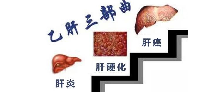 肝炎防治怎么办？来听听华山医院的张教授怎么说