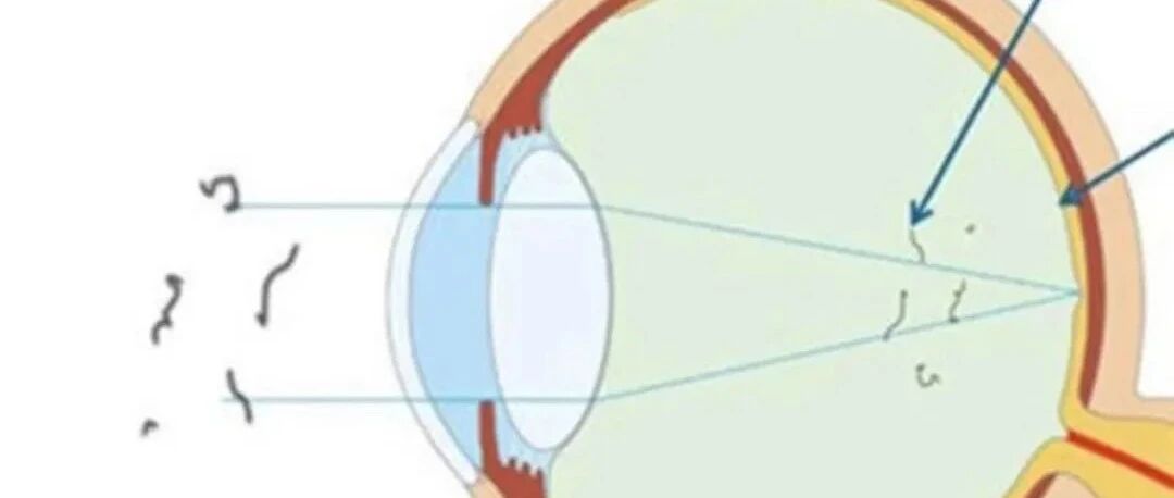 真假蚊子？别飞了！