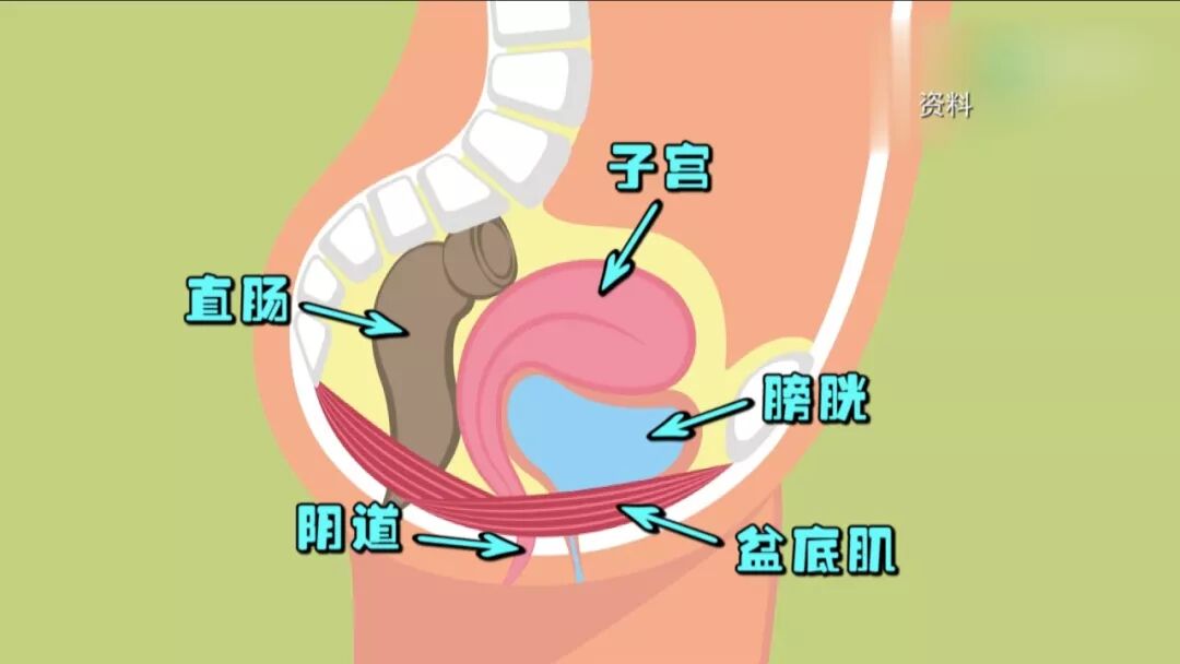 产后到底需不需要做盆底肌修复？