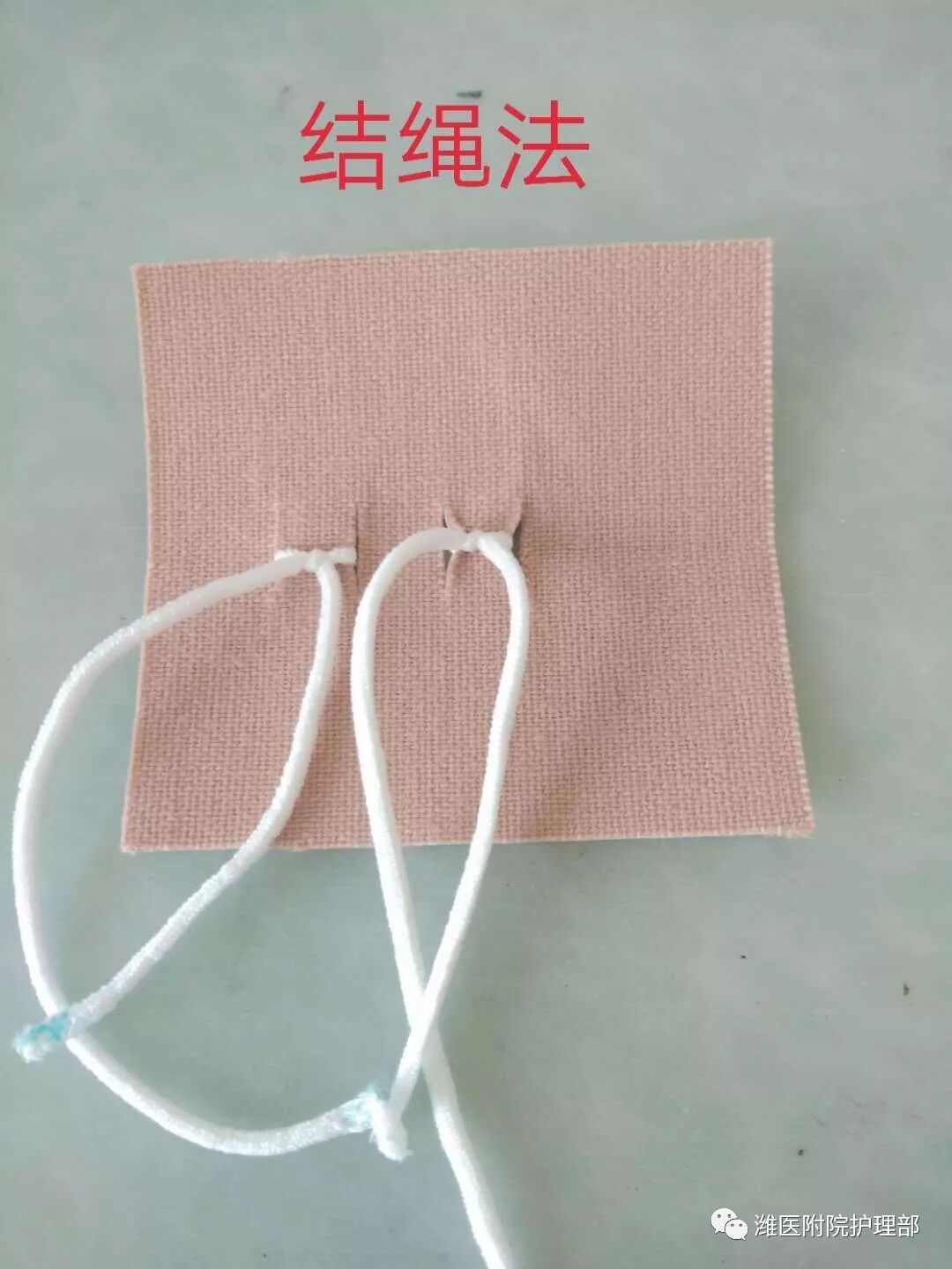 怎么固定引流管八种引流管固定方法，固定得结实又漂亮！_https://www.jmylbn.com_新闻资讯_第10张