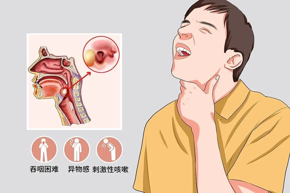 喉镜怎么不能无痛特色检查｜无痛又高清！这个利器可以让耳鼻喉科医生“镜”观其变_https://www.jmylbn.com_新闻资讯_第18张