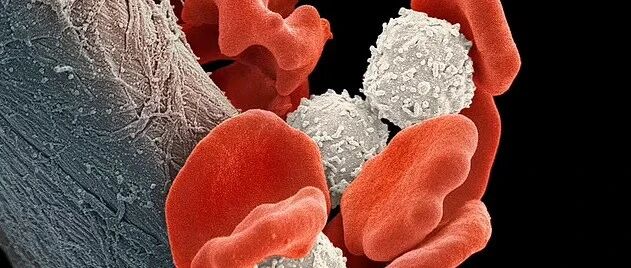 全球首例女性艾滋病患者被治愈，脐带血干细胞移植是治疗HIV的“终极武器”吗？