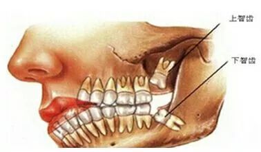 文章列表 文章详情 研究人员发现,西藏人的血液具有遗传倾向