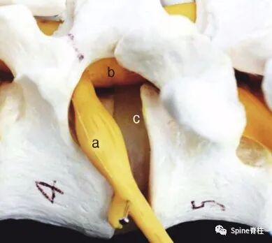 “安全三角”真的安全吗？——脊柱微创里的