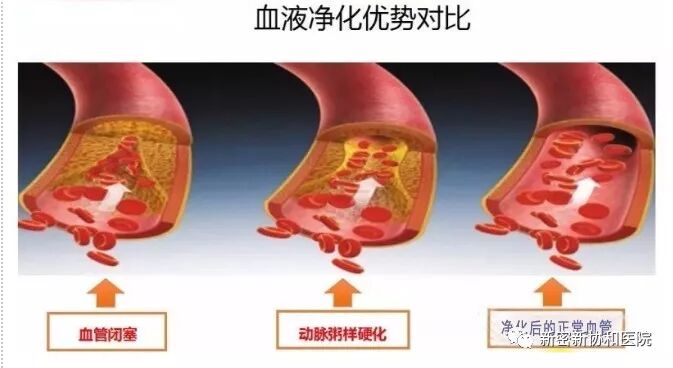 三氧疗法怎么代理德国三氧（O3）大自血疗法：能显著降脂软化血管疏通循环_https://www.jmylbn.com_新闻资讯_第2张