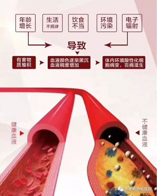 三氧疗法怎么代理德国三氧（O3）大自血疗法：能显著降脂软化血管疏通循环_https://www.jmylbn.com_新闻资讯_第6张