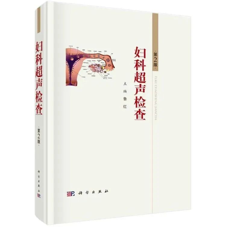子宫支架怎么取B超诊断宫内节育器位置的标准_https://www.jmylbn.com_新闻资讯_第4张