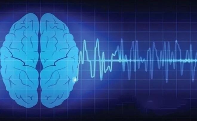 了解“脑波”