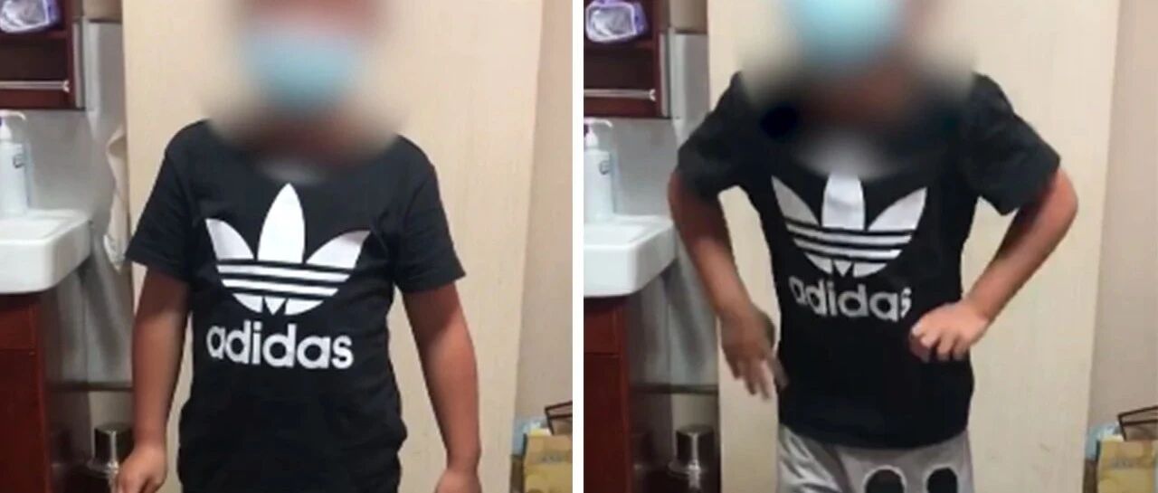 蹲起困难的肌营养不良患者，中医“五行肌康宁”治疗，8岁的他终于可以自由蹦跳了