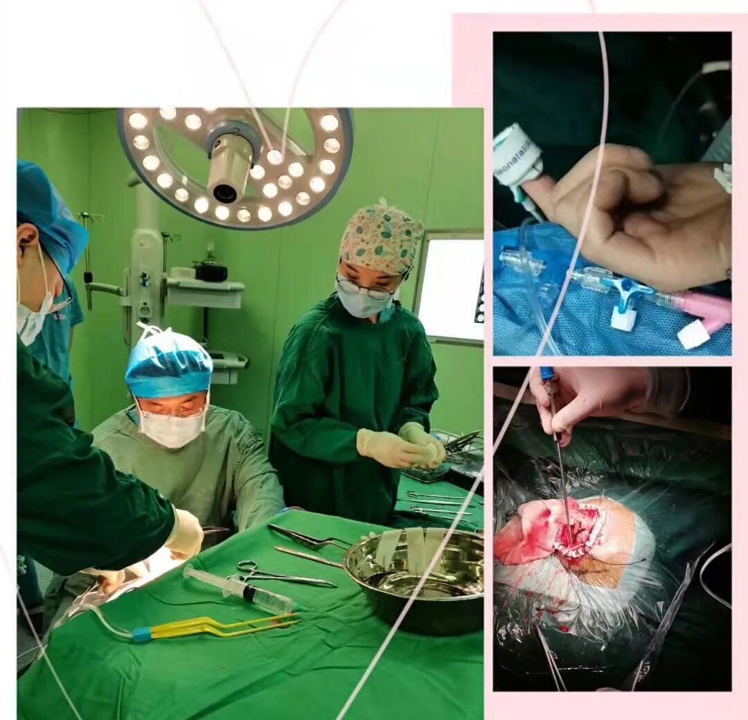 为什么使用手术对接车【护理驿站】手术室发现之旅_https://www.jmylbn.com_新闻资讯_第26张