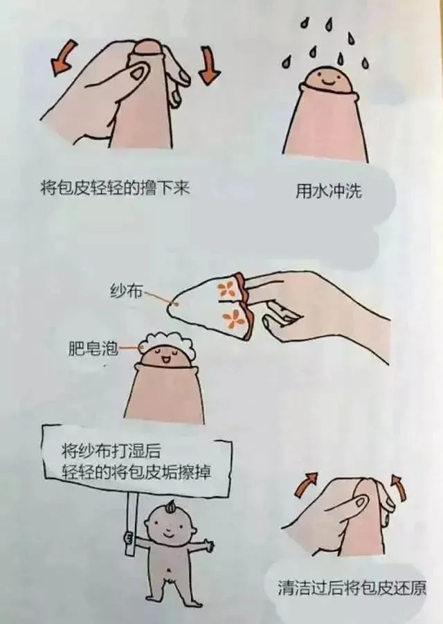 女孩子包茎正常的图片图片