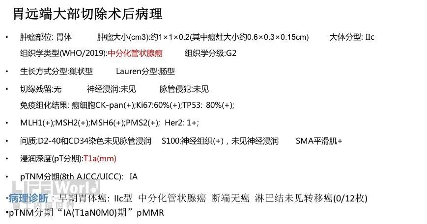 富士胃镜英文怎么写病例分享 ｜ 周环：一例不易判断的胃体病变的诊治分享（富士内镜早癌读片会）_https://www.jmylbn.com_新闻资讯_第38张