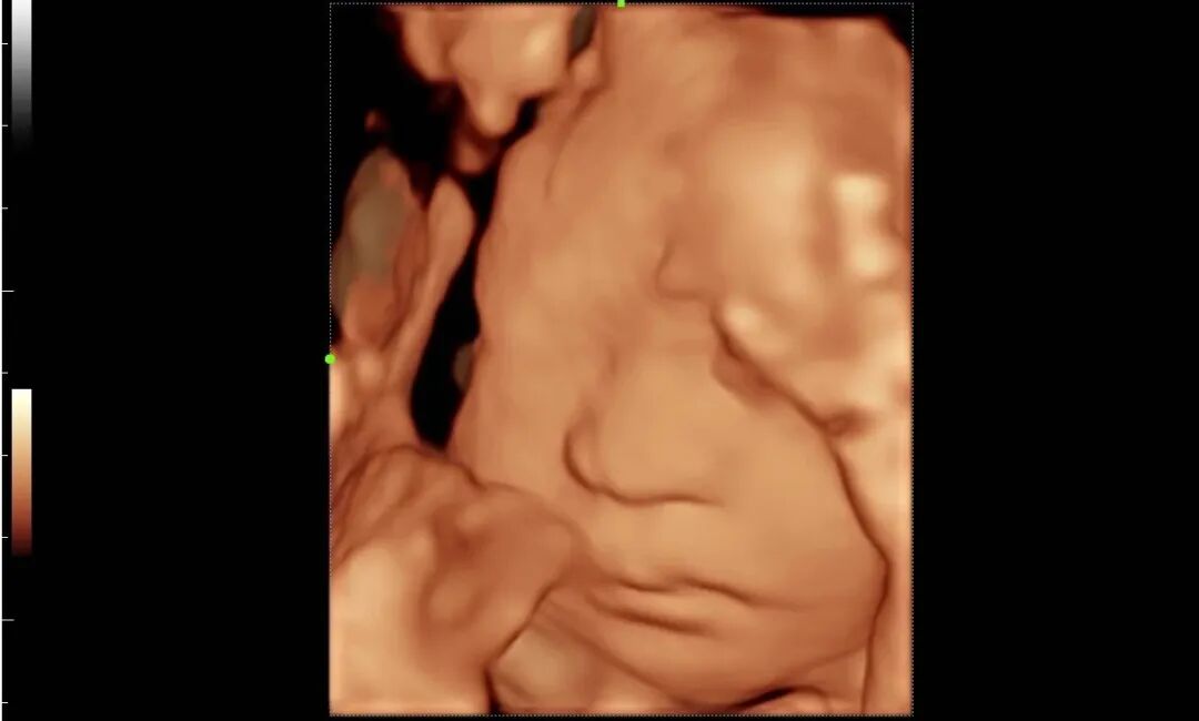 mindray超声怎么看参数【二轻医院喜报】mindray- Resonal9T高端彩色多普勒超声系统正式投入临床使用_https://www.jmylbn.com_新闻资讯_第7张