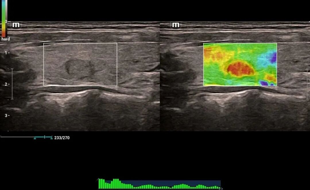mindray超声怎么看参数【二轻医院喜报】mindray- Resonal9T高端彩色多普勒超声系统正式投入临床使用_https://www.jmylbn.com_新闻资讯_第4张