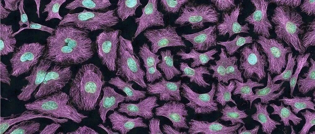 重磅！这种癌症将被消除！