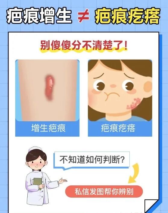 医用消疤贴怎么用【科普】疤痕增生疙瘩怎么才能消除？_https://www.jmylbn.com_新闻资讯_第4张