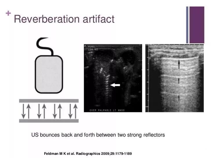 彩超伪像是什么【微课堂】二维超声常见伪像是如何产生的？_https://www.jmylbn.com_新闻资讯_第7张