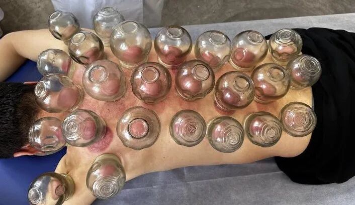 腰椎微波理疗是什么【特色科室】中医多学科传统诊疗中心_https://www.jmylbn.com_新闻资讯_第55张