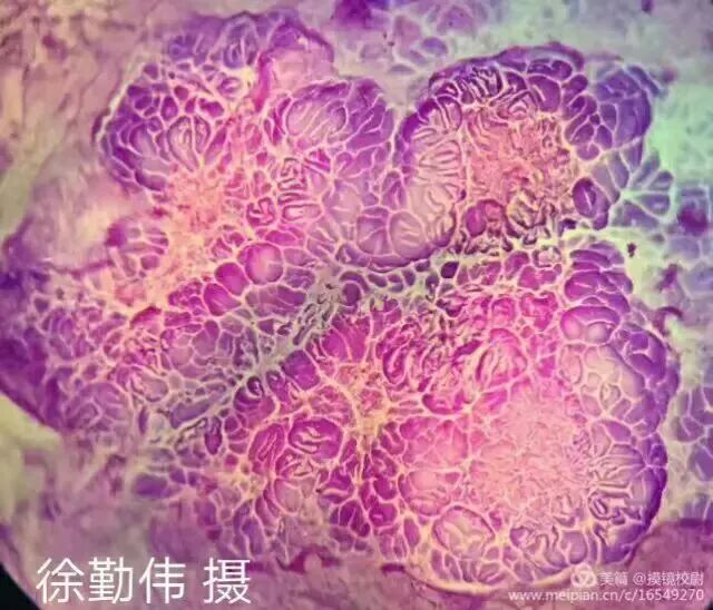 上皮细胞用什么染色内镜技术 ｜ 内镜黏膜染色剂的使用方法_https://www.jmylbn.com_新闻资讯_第4张