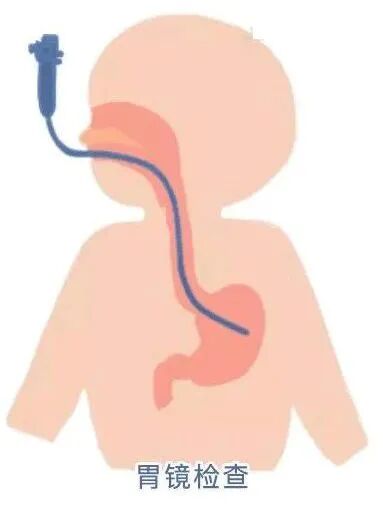 怎么检测手机螺旋仪好消息！我院内二科（内分泌科）引进YH04E-幽门螺旋杆菌检测仪_https://www.jmylbn.com_新闻资讯_第7张