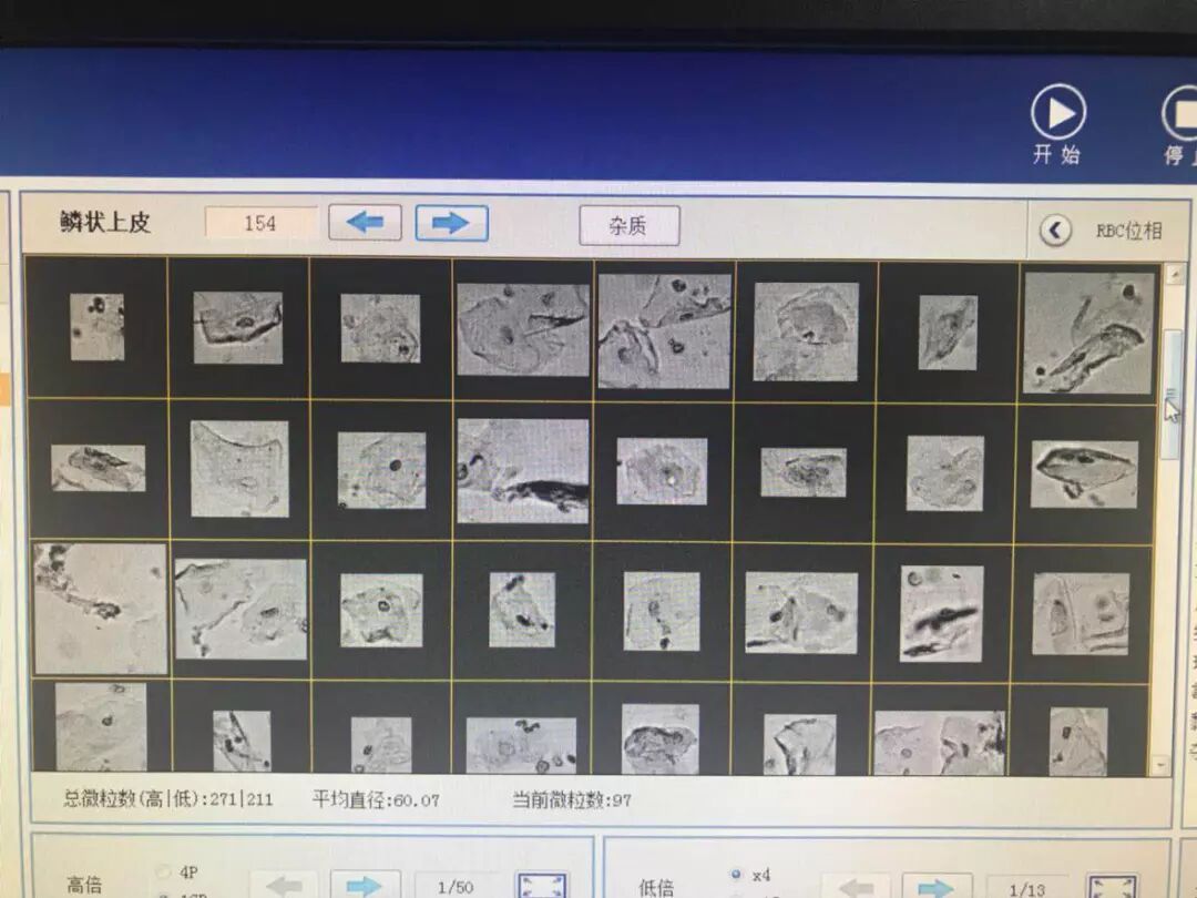 为什么要做尿液分析仪检验科尿液分析及尿沉渣分析仪简介_https://www.jmylbn.com_新闻资讯_第4张