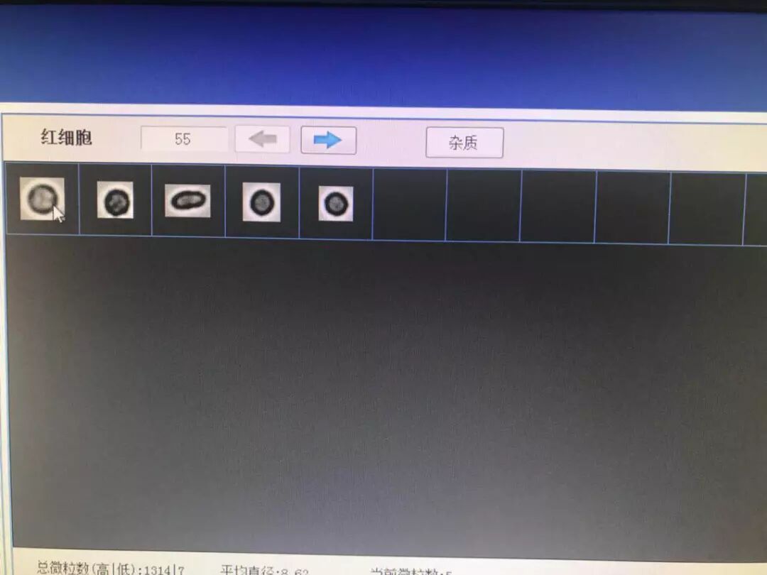 为什么要做尿液分析仪检验科尿液分析及尿沉渣分析仪简介_https://www.jmylbn.com_新闻资讯_第2张