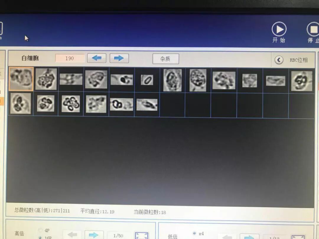 为什么要做尿液分析仪检验科尿液分析及尿沉渣分析仪简介_https://www.jmylbn.com_新闻资讯_第3张