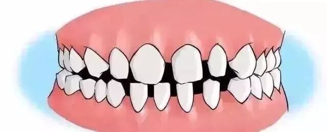 牙缝隙越来越大，原因竟是在这！