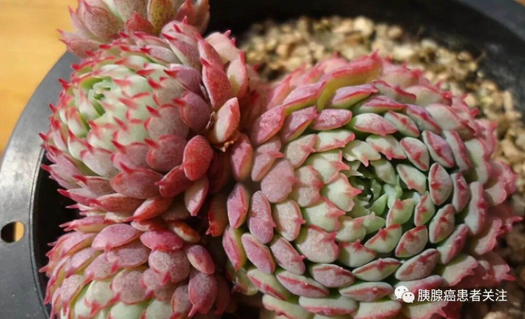5种多肉植物 颜值很高 度夏很难 新手朋友要慎入 全网搜