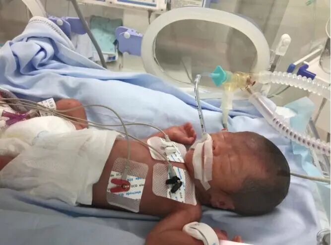 为什么新生儿抢救台【专科简介】危重新生儿救治中心——新生儿科_https://www.jmylbn.com_新闻资讯_第31张