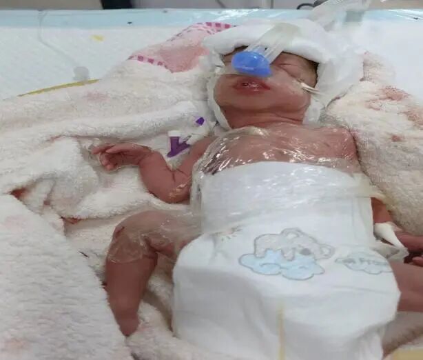 为什么新生儿抢救台【专科简介】危重新生儿救治中心——新生儿科_https://www.jmylbn.com_新闻资讯_第30张