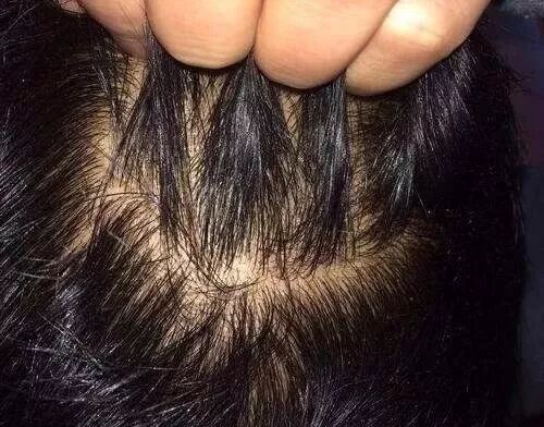 头发两天不洗就很油,说明身体有什么问题吗