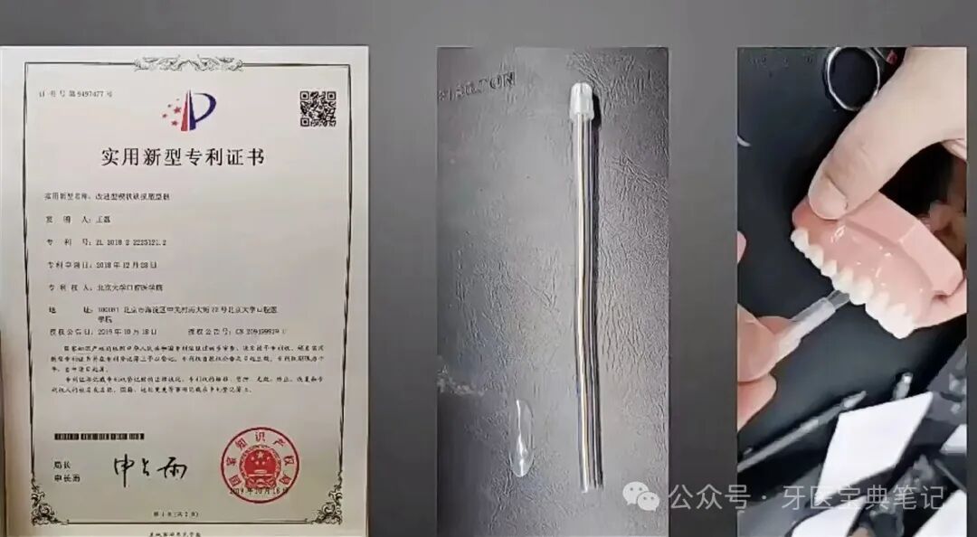 楔状缺损的补牙技巧！全是干货！
