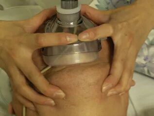 呼吸机呼气阀是什么简易呼吸器使用详解及注意事项_https://www.jmylbn.com_新闻资讯_第25张