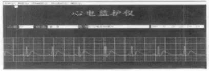 心电监护仪怎么看图解心电监护仪，那些基础知识你掌握了没？_https://www.jmylbn.com_新闻资讯_第6张