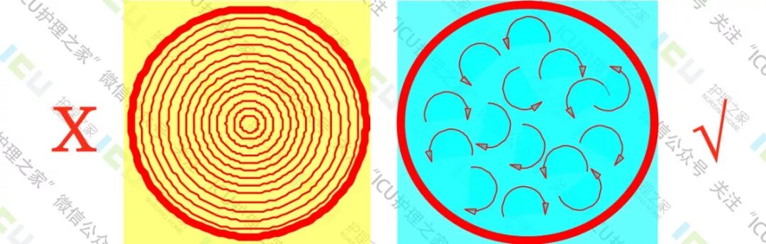 为什么要用推注泵PICC、CVC使用及维护_https://www.jmylbn.com_新闻资讯_第3张