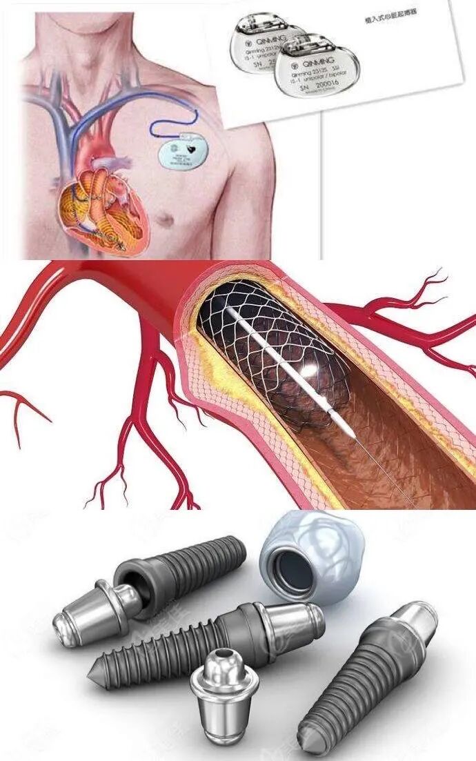 什么是一类医疗器械【质量管理】医疗器械知多少_https://www.jmylbn.com_新闻资讯_第6张