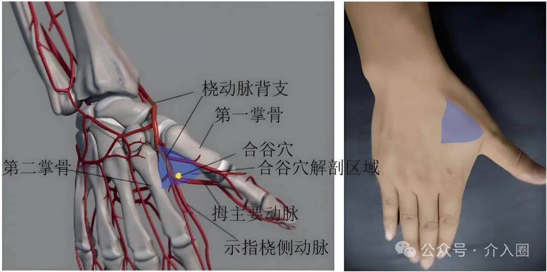 穿刺鞘英文怎么写桡动脉闭塞的开通方法_https://www.jmylbn.com_新闻资讯_第5张