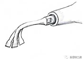 为什么骨科用摆锯白银市第二人民医院骨科二病区应用“切骨神器”超声骨刀完成一例腰椎后路减压手术_https://www.jmylbn.com_新闻资讯_第6张