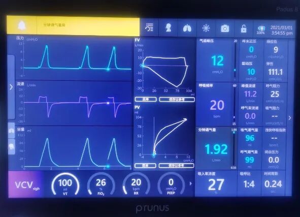 为什么呼吸机人机同步【涨知识】呼吸机人机不同步识别和处理_https://www.jmylbn.com_新闻资讯_第2张