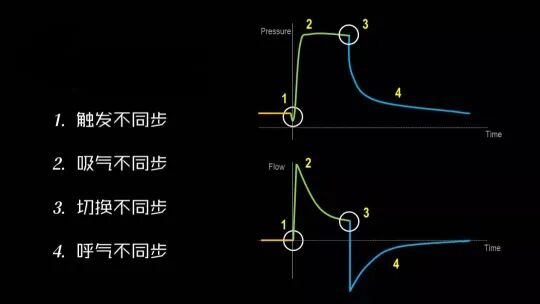 为什么呼吸机人机同步【涨知识】呼吸机人机不同步识别和处理_https://www.jmylbn.com_新闻资讯_第1张