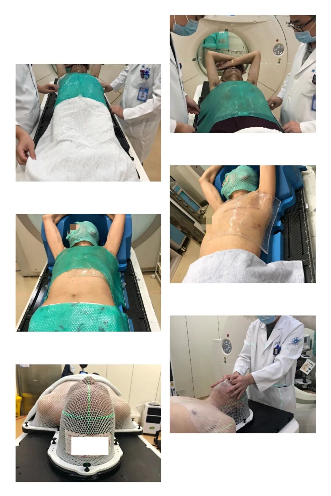 放疗做膜是什么意思一文图解｜放疗前需要做哪些准备工作？_https://www.jmylbn.com_新闻资讯_第12张