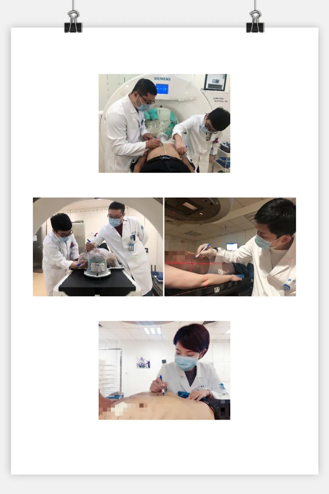 放疗做膜是什么意思一文图解｜放疗前需要做哪些准备工作？_https://www.jmylbn.com_新闻资讯_第13张