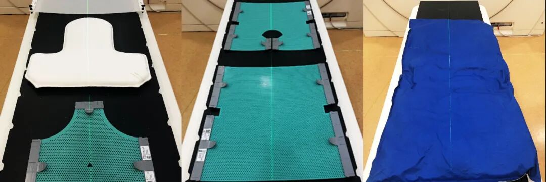 放疗做膜是什么意思一文图解｜放疗前需要做哪些准备工作？_https://www.jmylbn.com_新闻资讯_第10张