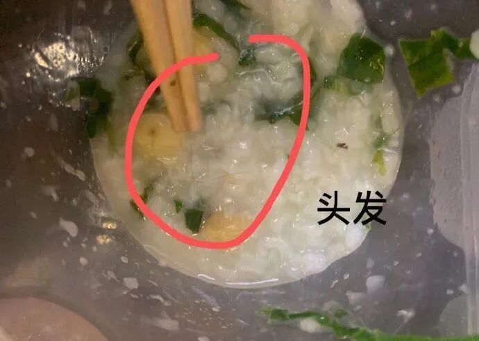 47位留学生回国隔离结果集体腹泻！酒店却说：水土不服（组图） - 6