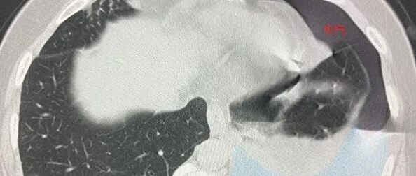 女子体内竟有近10种寄生虫！医生都惊呆，“与吃这些东西有关”